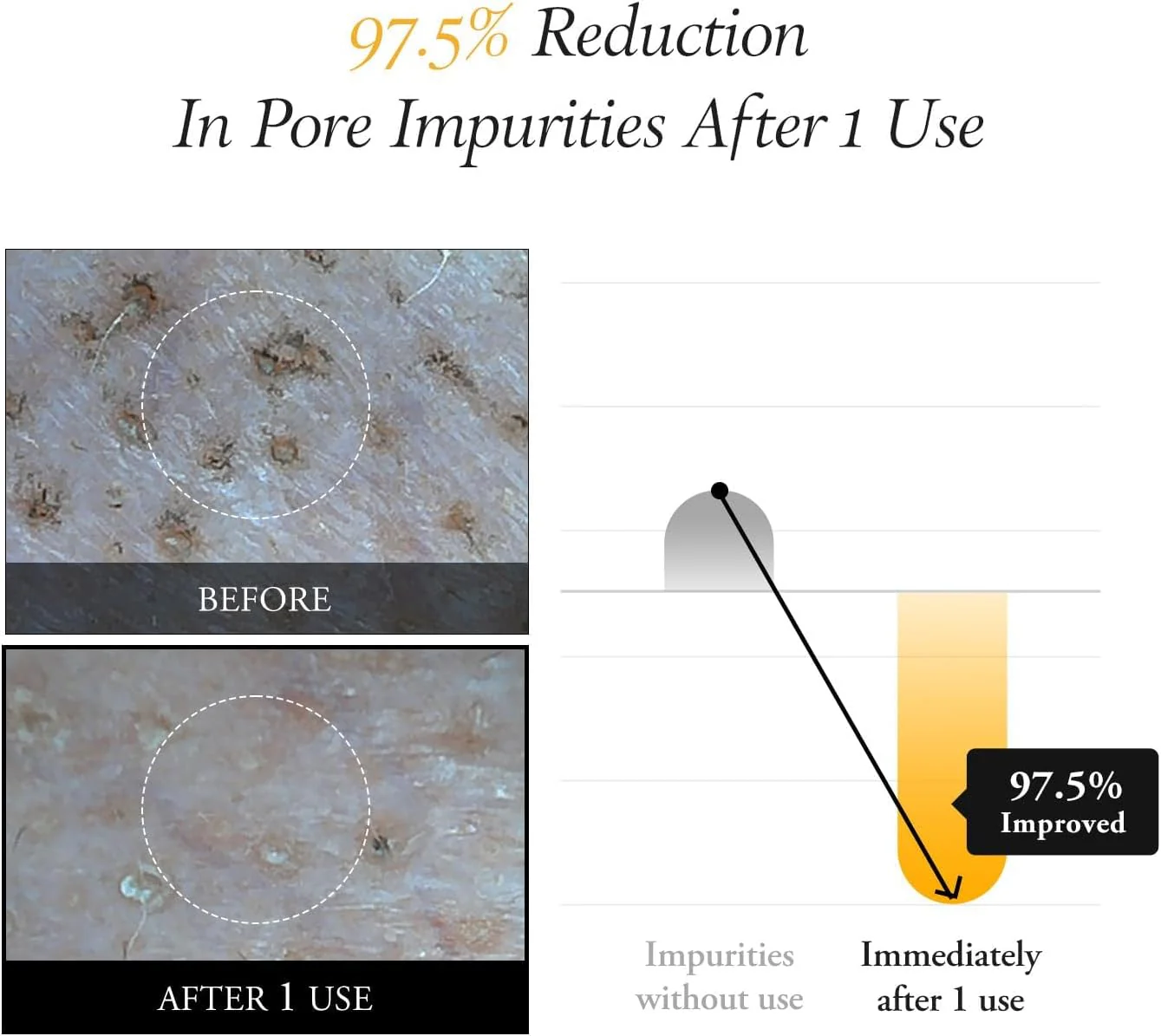 APRIL SKIN Calendula Peel Off Mask 100g - Image 7