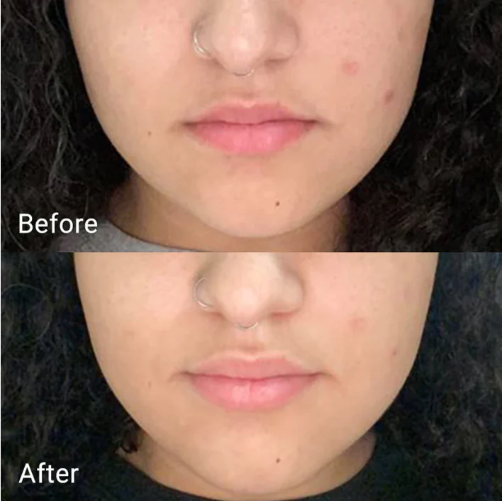 APRIL SKIN Calendula Peel Off Mask 100g - Image 8