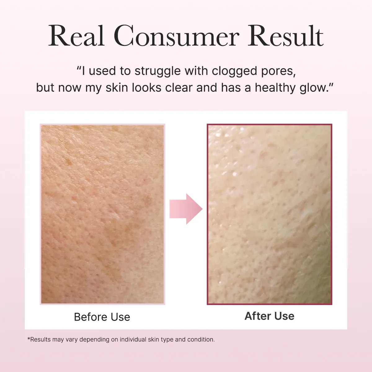 ARENCIA Fresh Rosehip Rice Mochi Cleanser 120g - Image 10