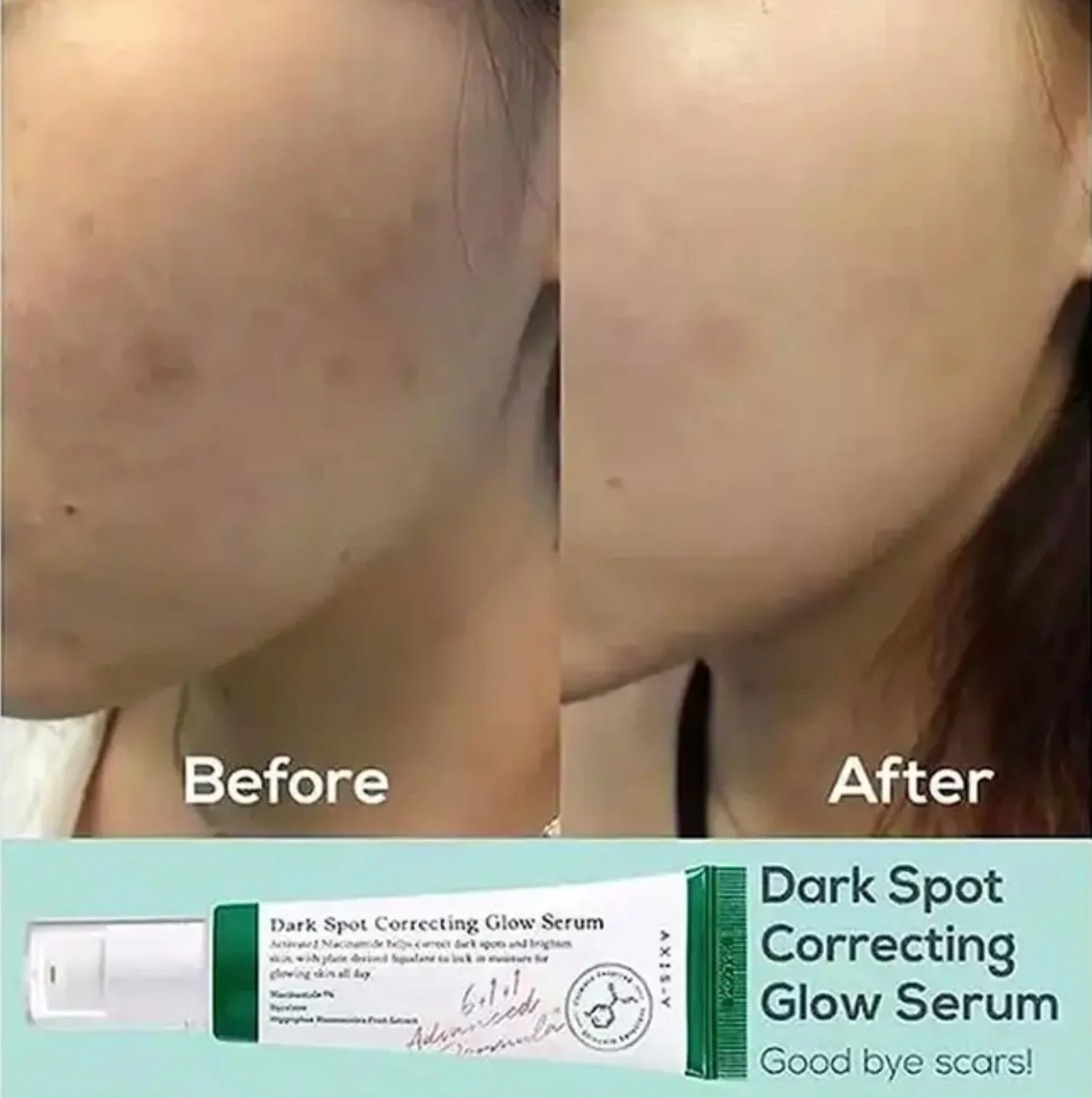 Axis-Y Dark Spot Correcting Glow Serum – Anti Pigmentation Serum - Image 6