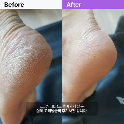 Baren 2 Ways Stainless Foot File - Image 7