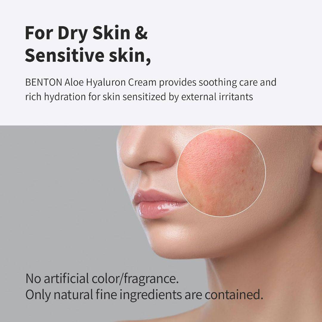 Benton Aloe Hyaluron Cream - Image 4