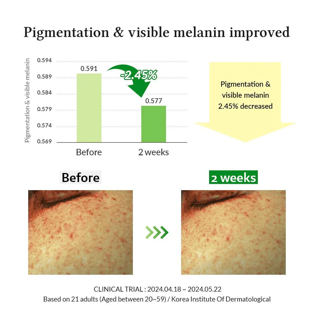 DR ALTHEA Gentle Vitamin C Serum 30mL - Image 7