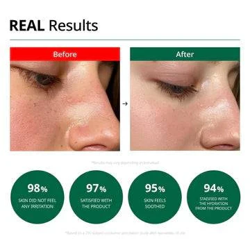 DR. G Red Blemish Clear Soothing Cream 70mL - Image 7