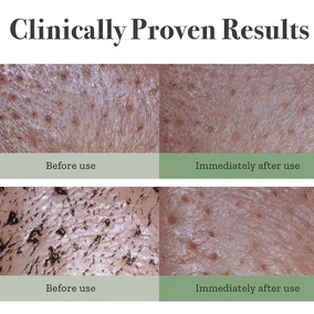 FULLY Green Tomato Clay Mask Cleanser 120mL - Image 5
