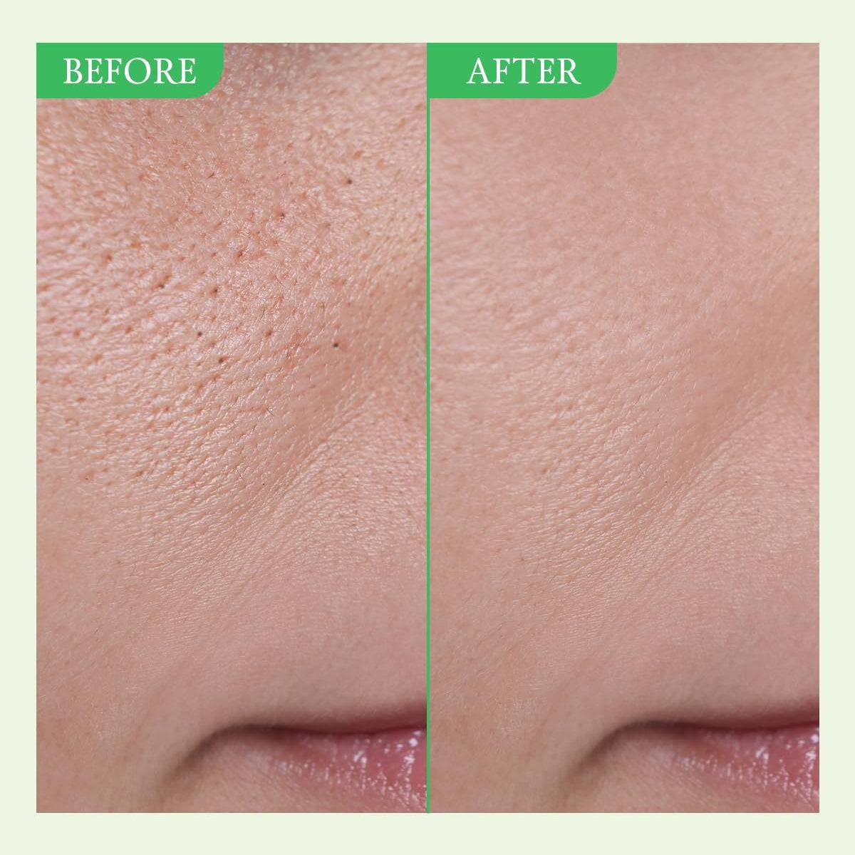 FULLY Green Tomato Serum 30mL - Image 7