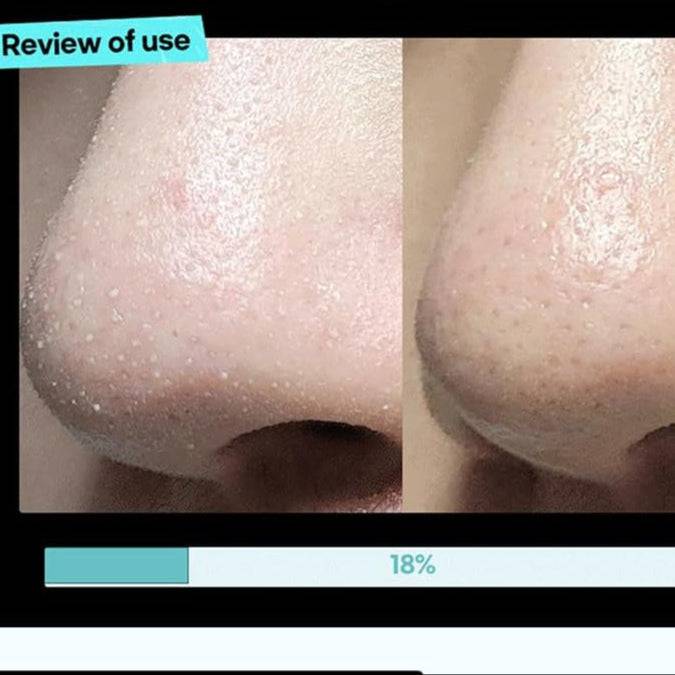 ILSO Super Melting Serum Softner + Cotton Pads - Image 10