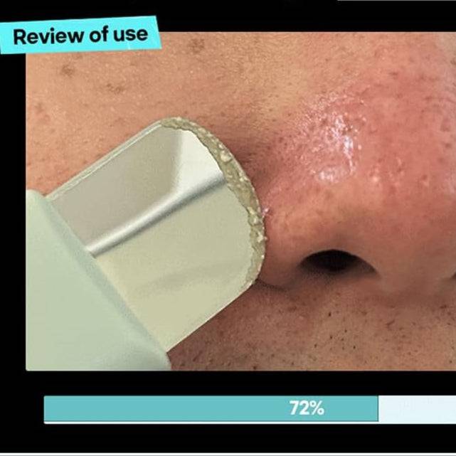 ILSO Super Melting Serum Softner + Cotton Pads - Image 11