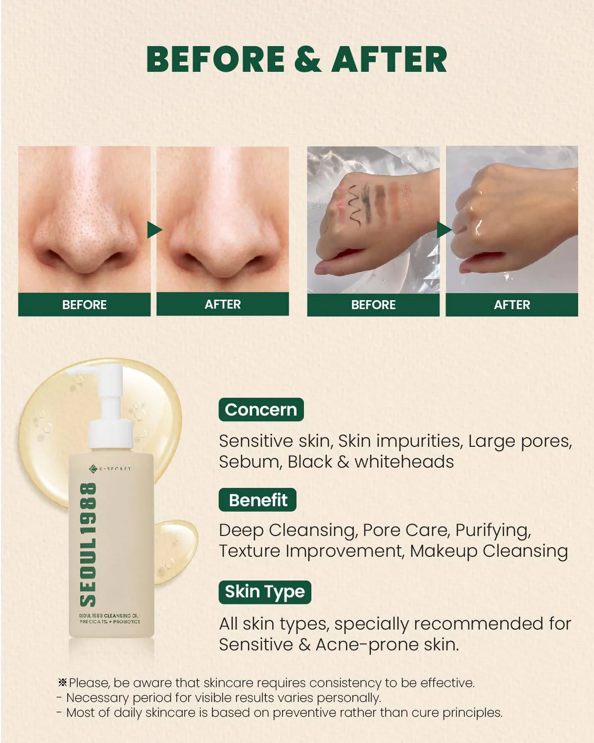 KSECRET Seoul 1988 Cleansing Oil: Pine Cica 1% + Probiotics 200mL - Image 5