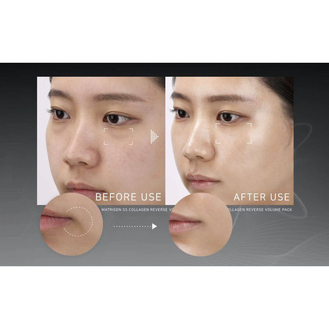 Matrigen SS Collagen Reverse Volume Pack ORIGINAL + 1 Spatula (Limited Quantity) - Image 7
