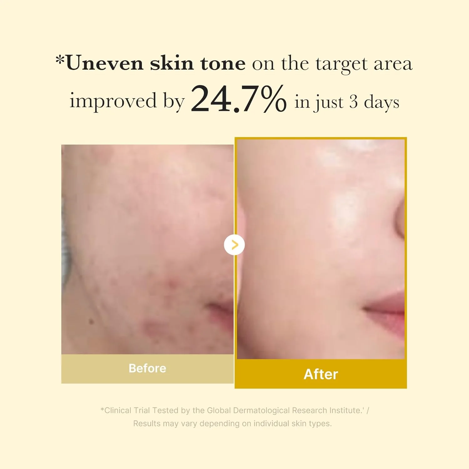 MEDICUBE Kojic Acid Tumeric Night Wrapping Mask 75mL - Image 4