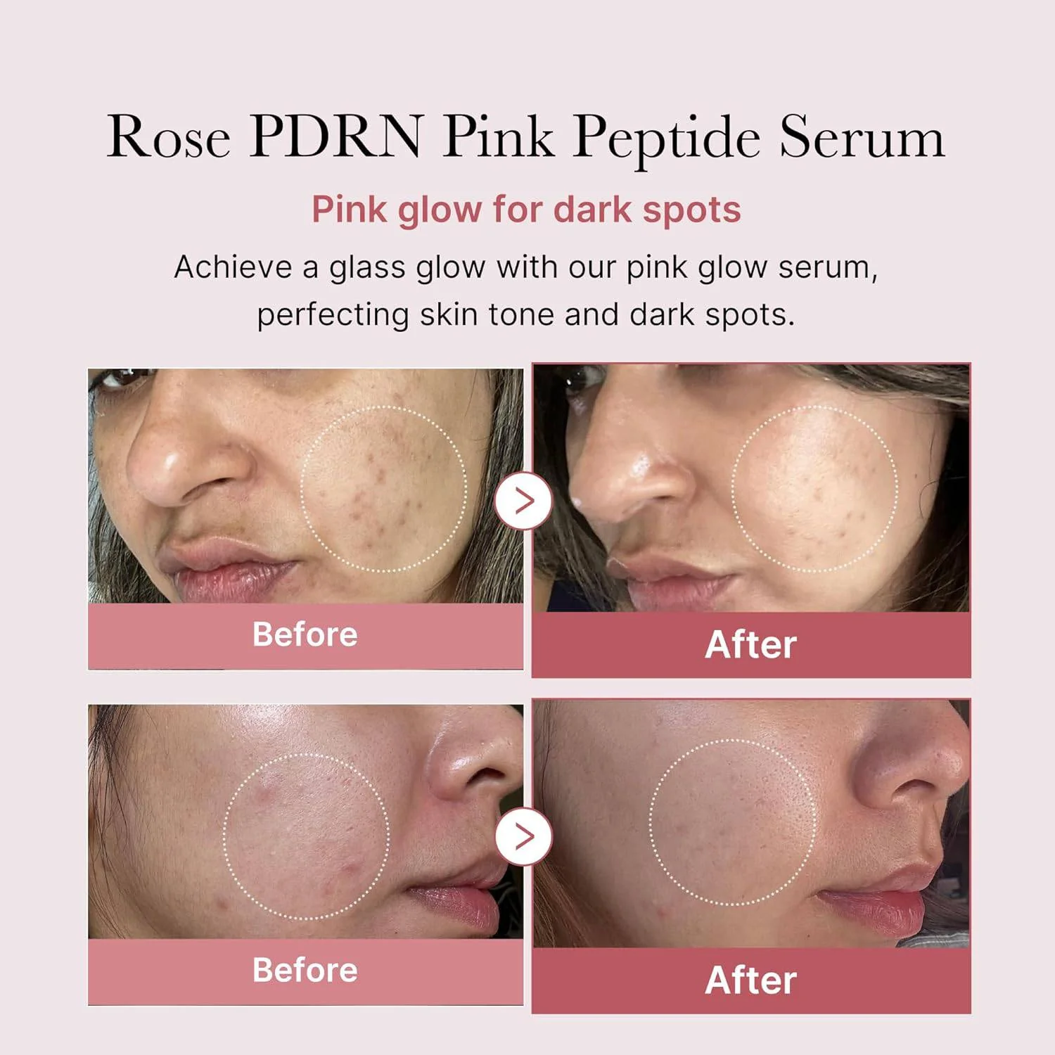 MEDICUBE PDRN Pink Peptide Serum 30mL - Image 6