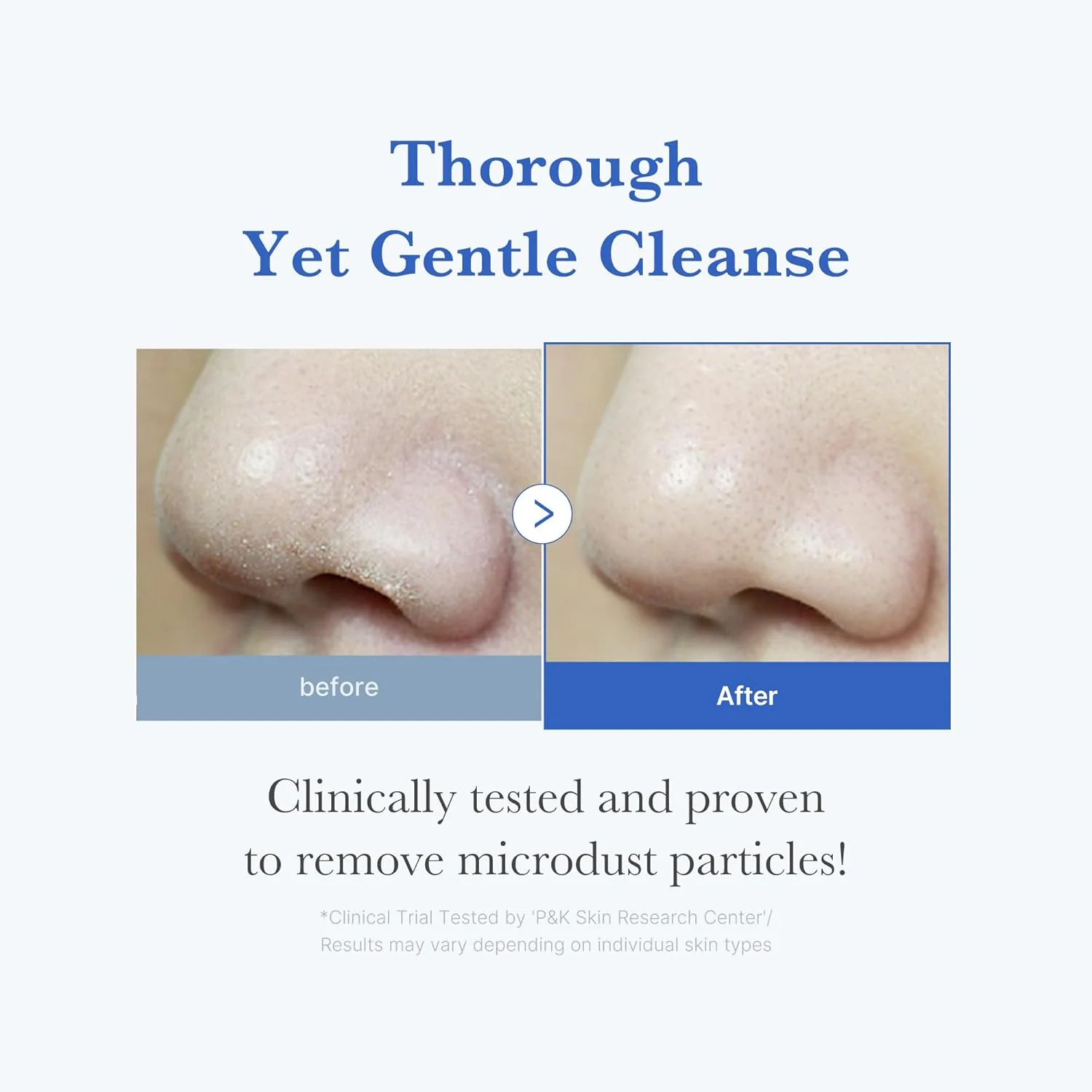 MEDICUBE Zero Foam Cleanser 120g - Image 4