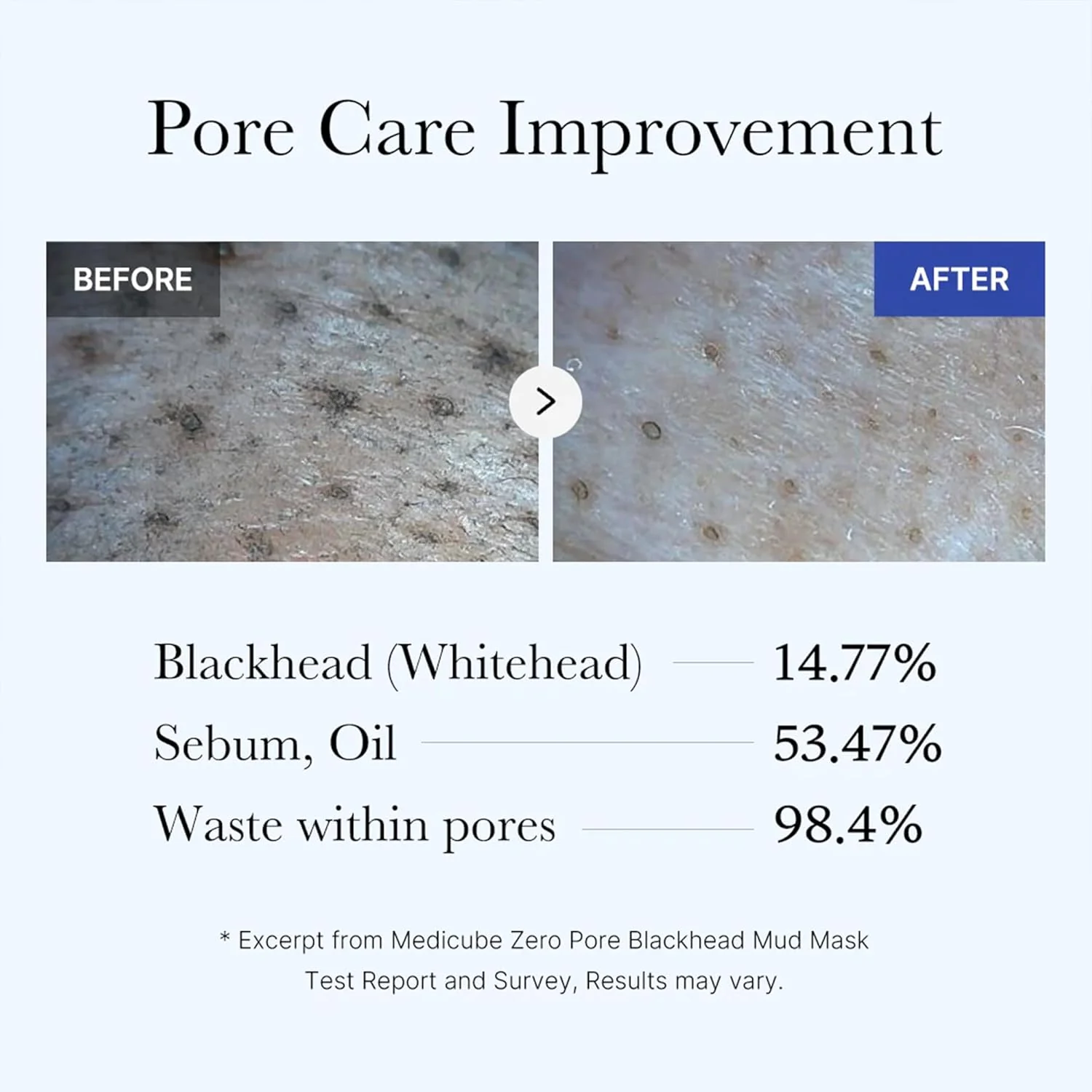 MEDICUBE Zero Pore Blackhead Mud Mask 100g - Image 6