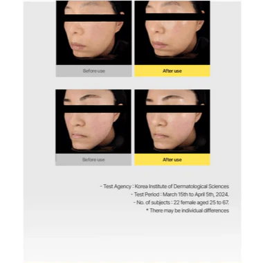 ONGREDIENTS Skin Barrier Calming Mask 27mL (1ea) - Image 15