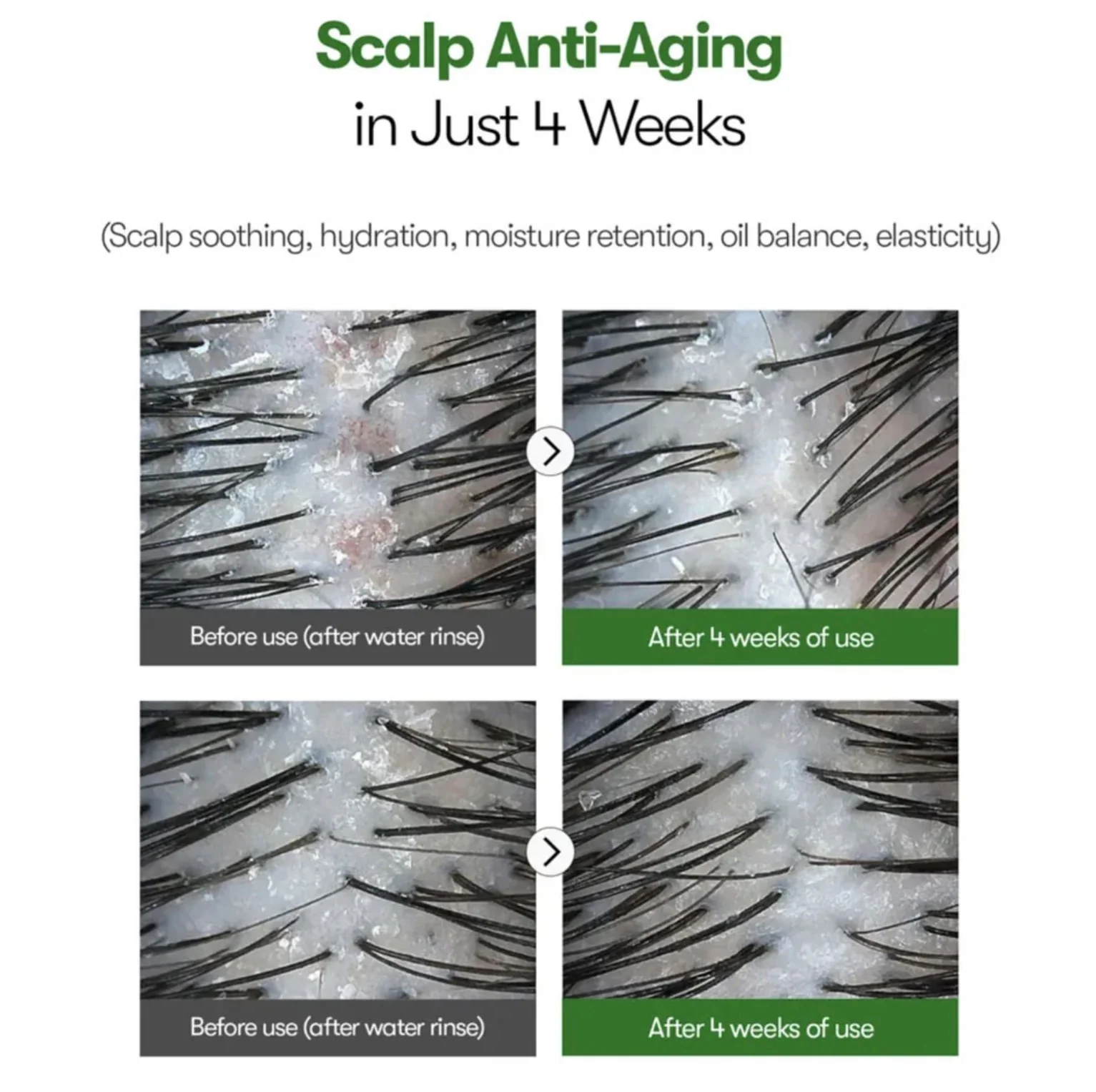 VT Cosmetics PDRN Reedle Shot Hair Ampoule 100dL 15mL - Image 4